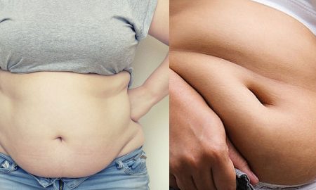 belly-fat